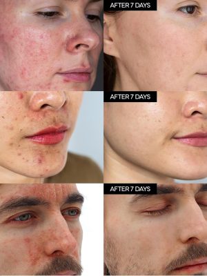 ivoskin - Intensive Cica Repair Cream