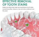 Eelhoe - Teeth Whitening Mouth Spray