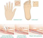 Active Corn Remover Gel-3.jpg