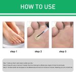 Active Corn Remover Gel-5.jpg