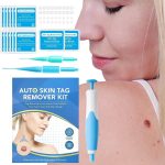 Auto Skin Tag Remover-1.jpg
