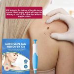 Auto Skin Tag Remover-7.jpg
