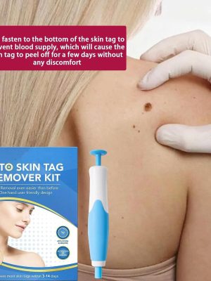 Auto Skin Tag Remover-7.jpg