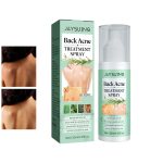 Back Acne Treatment Spray-1.jpg