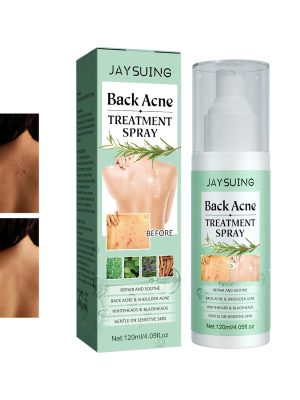 Back Acne Treatment Spray-1.jpg