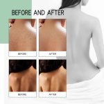 Back Acne Treatment Spray-6.jpg