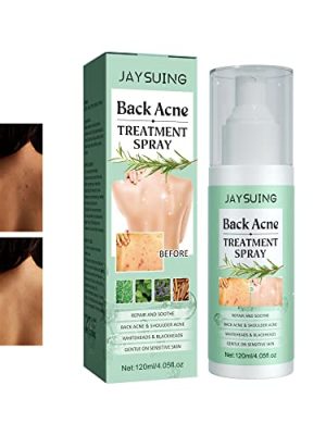 Back Acne Treatment Spray-9.jpg