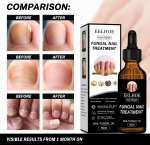 Fungal Nail Treatment Oil