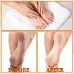 Eelhoe Foot Peeling Spray-3.jpg