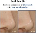 Isntree Hyper Acid4 Serum-4.jpg