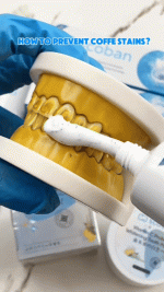 Scoban - Teeth Whitening