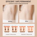 Babyverse - Digital IPL Hair Removal Device © - Zambeel