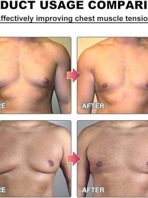Men Therm - Bee Venom Gynecomastia Heating Oil (Original) - Zambeel