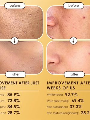 Moolinse Peel Shot P5 Exfoliant Ampoule (Pack of 2) - Zambeel