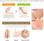 Purederm - Moisturizing Heel Crack Remover (Original) - Zambeel