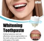 Scoban - Teeth Whitening (Original) - Zambeel