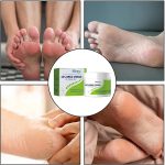 South Moon - 42% Urea Cream + 2% Salicylic Acid (Original) - Zambeel