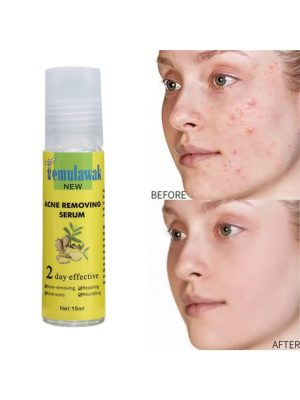 Temulawak - New Acne Removing Serum (Original) - Zambeel