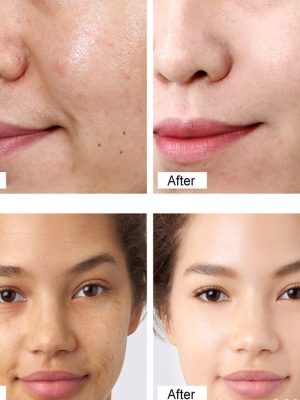 Vibrant Glamour - Retinol Cream - Zambeel